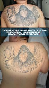 Фотография Er.Laser 4